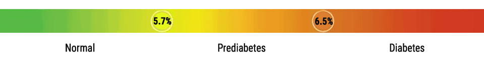 A graph showing the A1C numbers from healthy to prediabetes to diabetes.