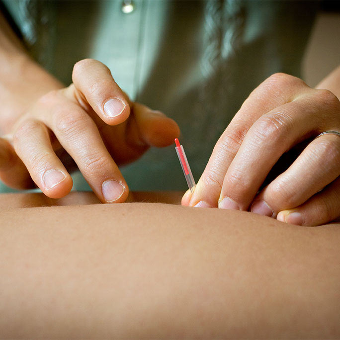Careful hands manipulate acupuncture.