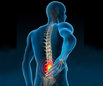 Illustration of lower back pain.