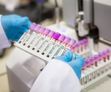 Vials in a laboratory setting