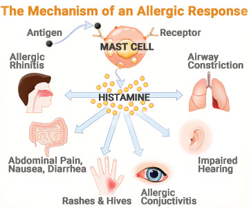 Illustration showing the mechanism of allergic response.