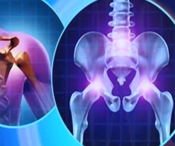 colorful orthopedic cancer graphic for prostate cancer to bone seminar